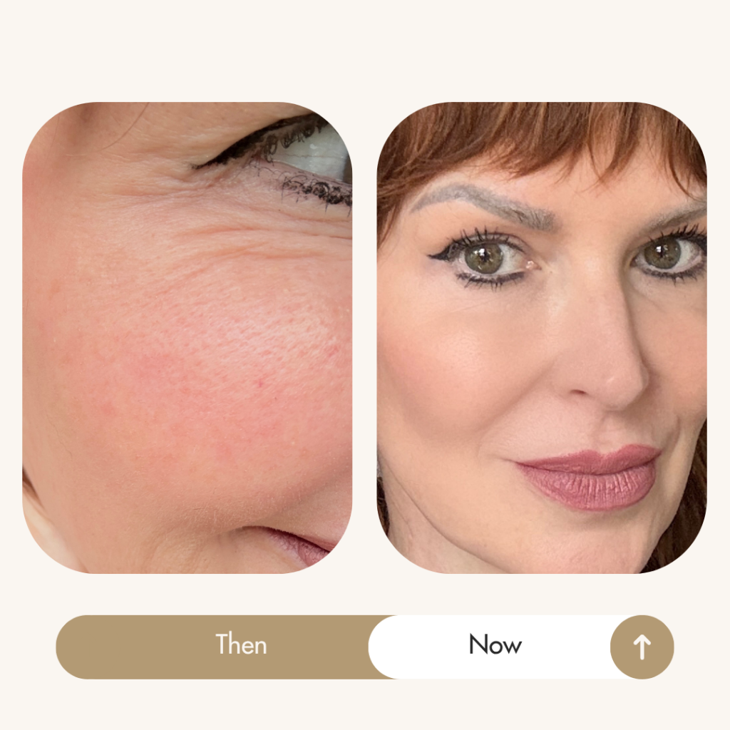 Sadie Nardini before and after: eye area lifted with Face HIIT workouts